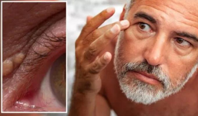 Vrei să scazi colesterolul în mod natural? Iată câteva modificări ale stilului de viață