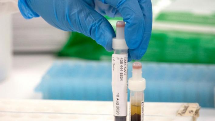 Colesterolul „bun“ ar putea fi doar un mit. Un studiu zdruncină una din recomandările medicale din ultimele decenii