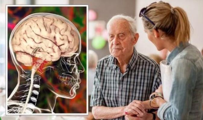 Simptome demență. Medic: Apar cu 9 ani înainte de diagnostic