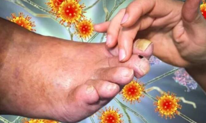 Demența: Modificările la nivelul unghiilor pot fi observate în etapa incipientă a bolii