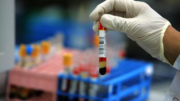 Testul de sânge care ar putea elimina chimioterapia pentru unii pacienți cu cancer