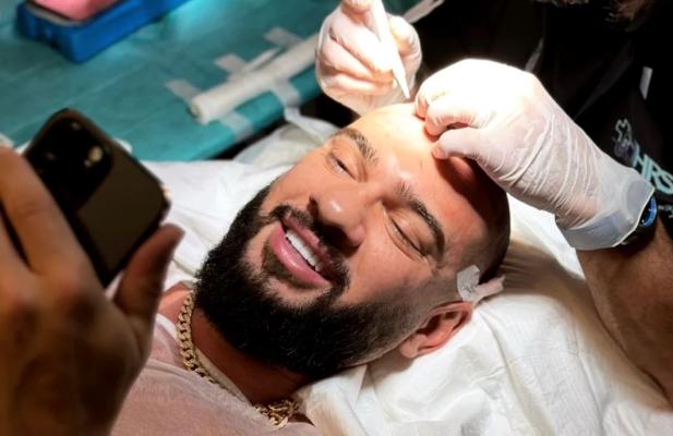 Dorian Popa a suferit o intervenție estetică, la început de 2023. Cum arată acum