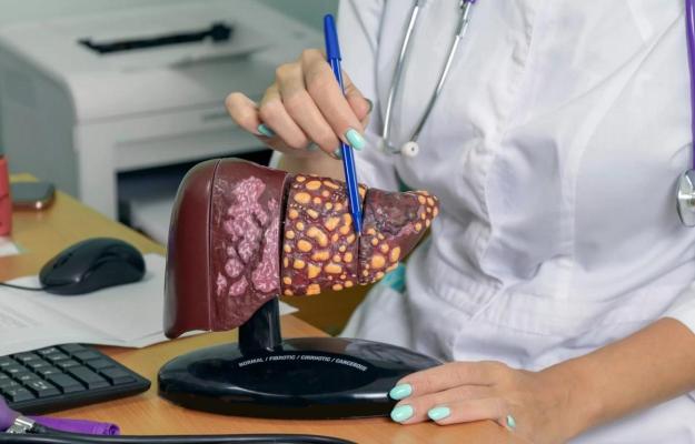 Boala ficatului gras pune în pericol sănătatea altui organ
