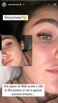 Alexia Eram, probleme de sănătate în vacanța din Bali
