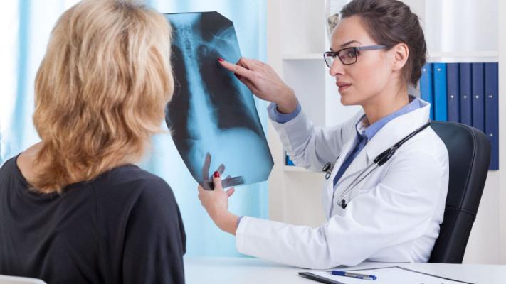 Simptome și semne clinice care au indicație obligatorie de radiografie pulmonară