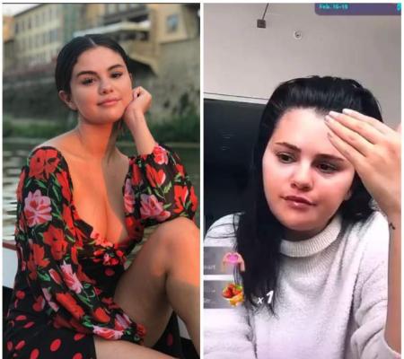 Selena Gomez s-a îngrășat din cauza tratamentului pentru boala de care suferă