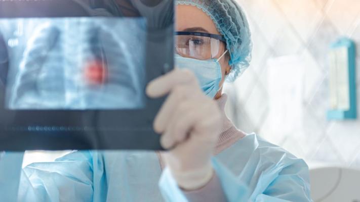 Legătura dintre aportul excesiv de vitamina B și cancerul pulmonar