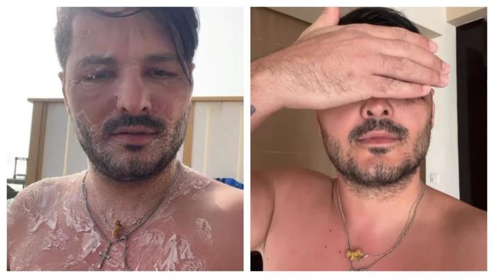 Liviu Vârciu, ultimele detalii despre starea de sănătate: „Acum s-a uscat pe față”