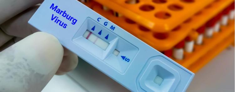 Alertă medicală! A fost detectată febra hemoragică Marburg, o boală infecţioasă mortală