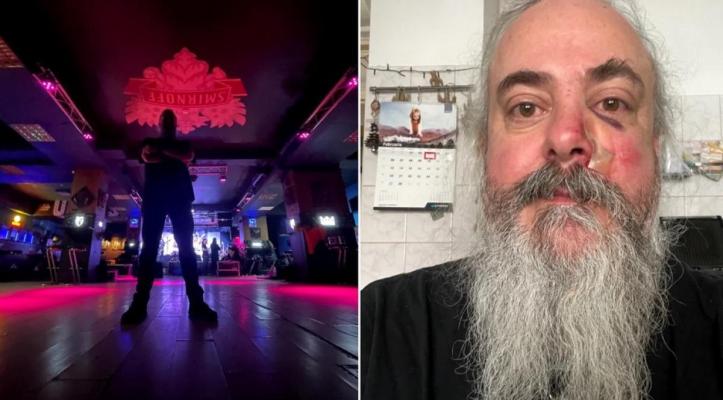 Celebrul solist al trupei Bucovina, bătut după concert. A fost atacat de 4 tineri
