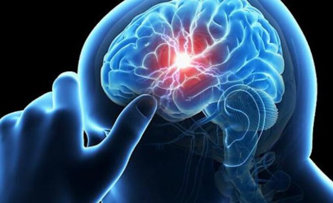 Tratamentul care salvează viața celor cu atac cerebral
