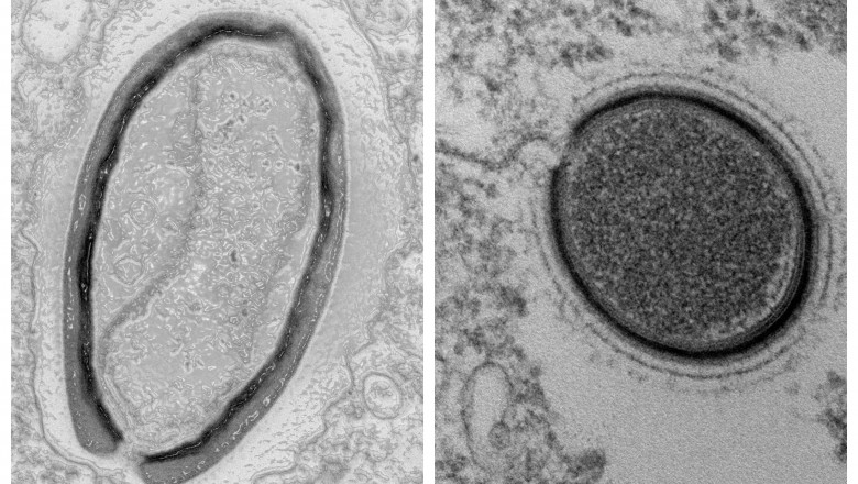 De ce a fost inviat un „virus zombie” vechi de 50.000 de ani si cat de mare e riscul unei pandemii
