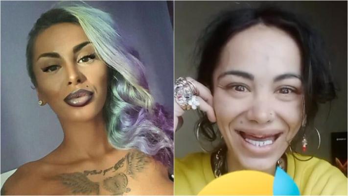 Alina Eriko, verișoara Loredanei Chivu, a ajuns de nerecunoscut din cauza substanțelor interzise
