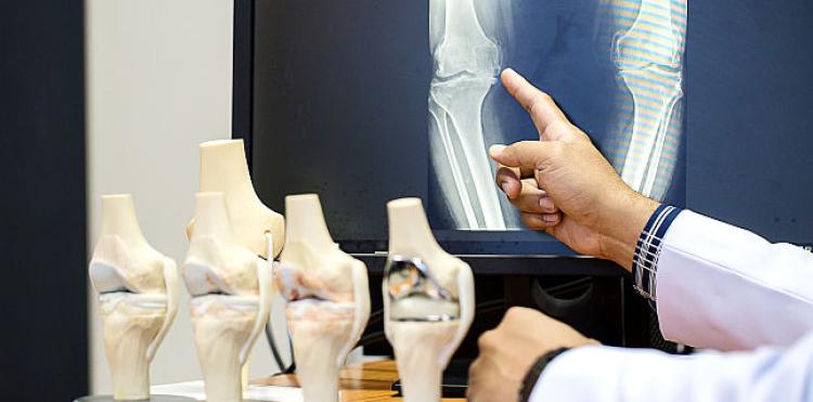Cum îți dai seama că ai început de osteoporoză. Ce trebuie să știe toate femeile