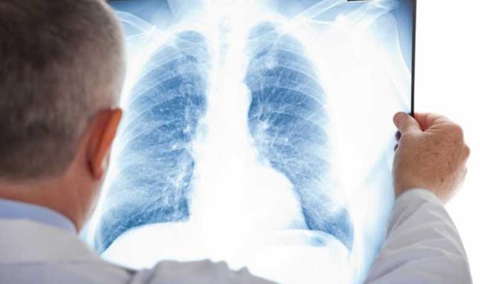 Un spital din Spania a realizat un transplant pulmonar cu ajutorul unui robot cu patru braţe