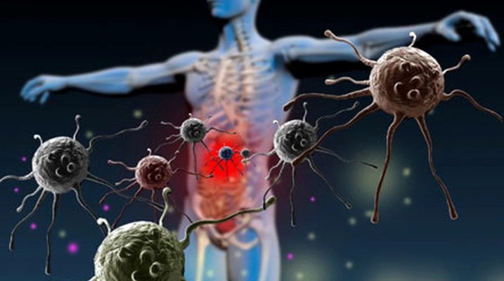 Descoperirea cercetătorilor: Hormonul care ajută cancerul să scape de sistemul imunitar