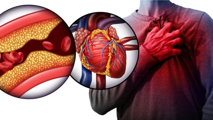 Antidotul colesterolului crescut: Ingredientul nelipsit din dieta asiaticilor