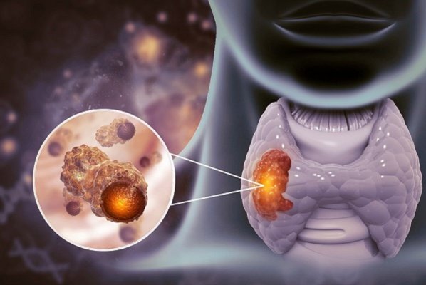 Simptome alarmante care indică apariția unei tulburări tiroidiene