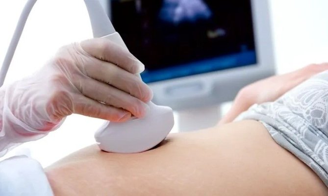 FABC: Depistat în stadii incipiente, cancerul ovarian poate fi vindecat în 90 - 95% dintre cazuri