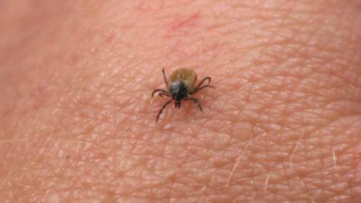 Atenție! Dacă o căpușă este ruptă, iată ce trebuie făcut