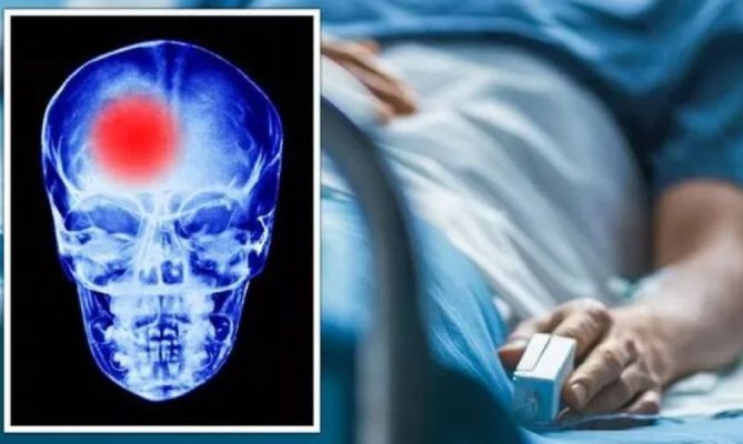 Medic: Două tipuri de carne pot crește cu 14% riscul de accident vascular cerebral