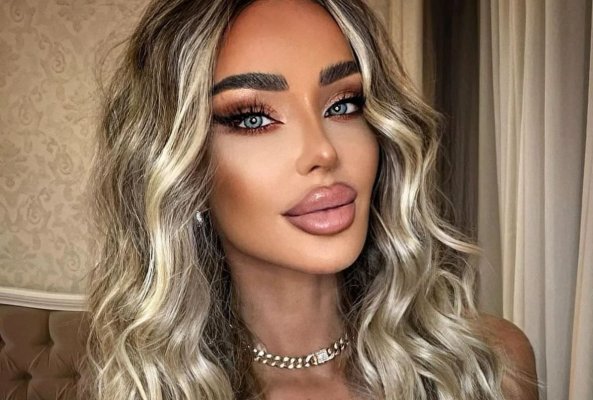 Bianca Drăgușanu a ajuns, din nou, pe mâna medicului estetician. La ce intervenție estetică a apelat