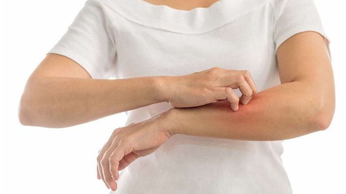 Cele mai comune alergii: 5 factori declanșatori