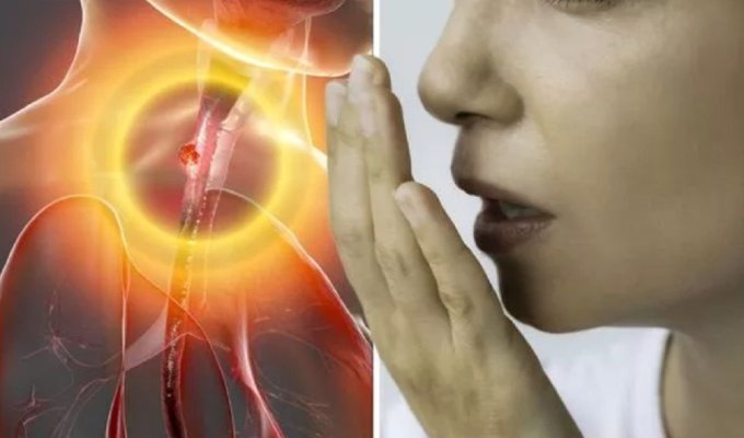 Simptomele ucigașului tăcut care nu trebuie ignorate niciodată