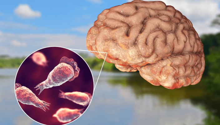 Naegleria fowleri, amiba care trăiește în apă și 'mănâncă' creierul uman, a ucis un copil de 2 ani