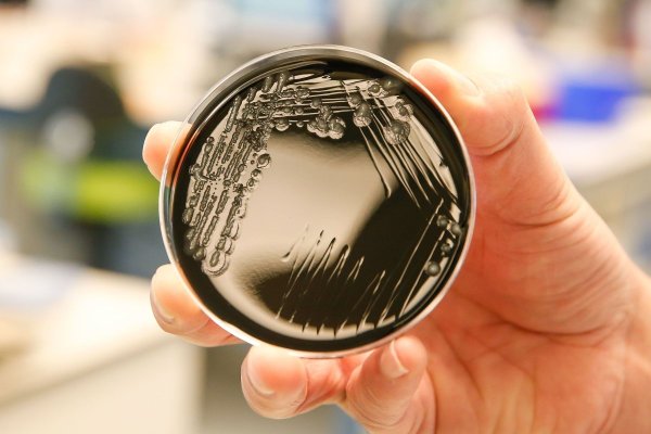 Legionella face ravagii într-un orășel din Polonia. Bilanțul a crescut la 11 morţi şi 144 de persoane infectate