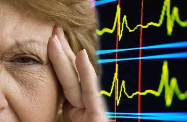 A fost inventată o cască pentru diagnosticarea rapidă a accidentului vascular cerebral