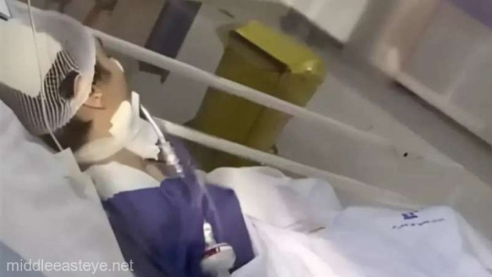 Iran: Germania şi SUA, îngrijorate de soarta unei tinere, în comă după o altercaţie cu poliţia