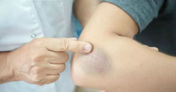 Cum îți arată organismul că suferi de deficit de vitamine: Simptomele pe care să le urmărești