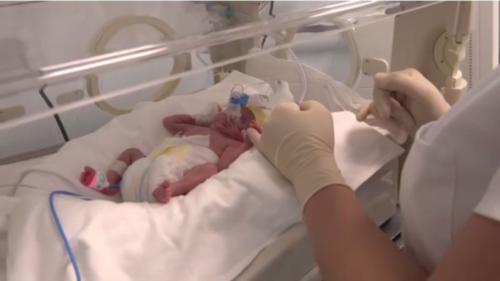 Minune! Un bebeluș de 500 de grame, născut la Euromaterna, a supraviețuit. Video
