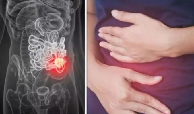 Medic: Cu ajutorul acestui condiment ieftin, intestinul tău va funcționa precum un ceas