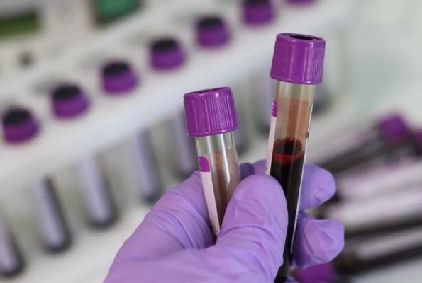Opt analize de rutină care descoperă cancerul înainte de apariția simptomelor