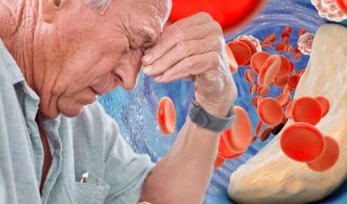 Simptome care pot indica că aveți o arteră înfundată