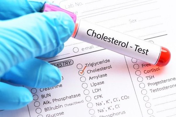Colesterolul prea scăzut poate anunța hepatita C și unele tipuri de cancer