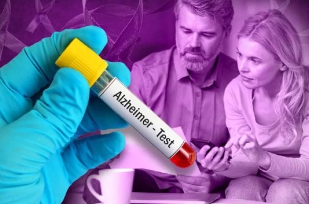 Analiza de sânge care poate diagnostica Alzheimer cu o precizie de 95%