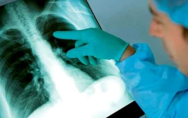  Un simplu test de sânge ar putea identifica milioane de persoane care răspândesc o boală mortală fără să știe