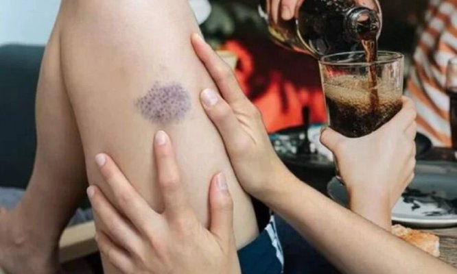 Băutura populară cu cofeină care crește riscul de cheaguri de sânge