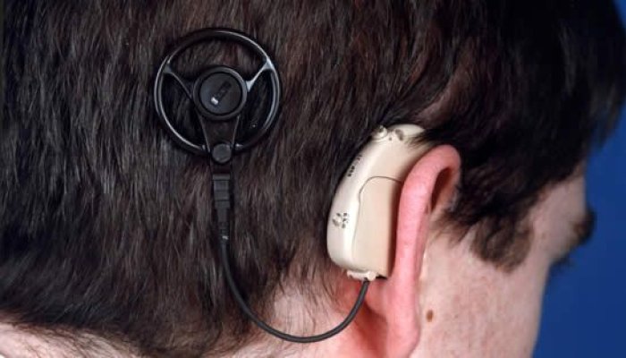 Carmen Orban: Registrul Naţional de Implant Cohlear este o urgenţă absolută