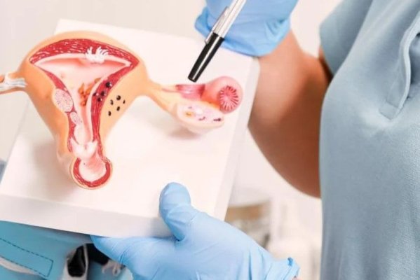 Atenție! Aceste produse de igienă cresc riscul de cancer ovarian