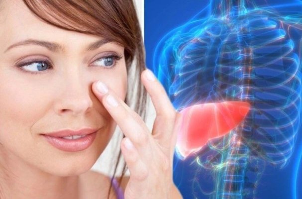 Semne care apar în ochi și care indică boala ficatului gras