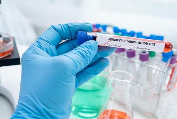 O versiune periculoasă a mpox se răspândește. Nu există nici un medicament împotriva acesteia