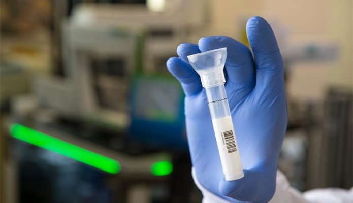 Descoperire revoluționară! Un tip de cancer, depistat printr-un test de salivă