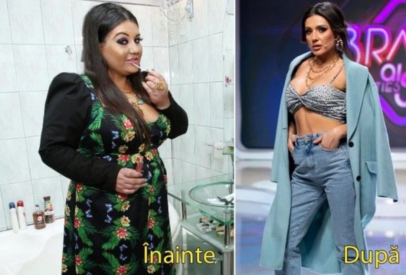 Ce mai poate mânca Bianca Rus după ce și-a tăiat stomacul?