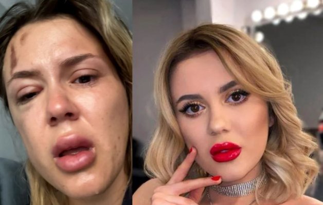 Emily Burghelea, la un pas de moarte după un accident grav! A filmat tot impactul. Video