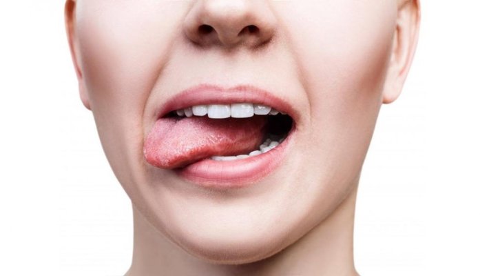 O nouă descoperire: Bacteria din gură care „topește” cancerul