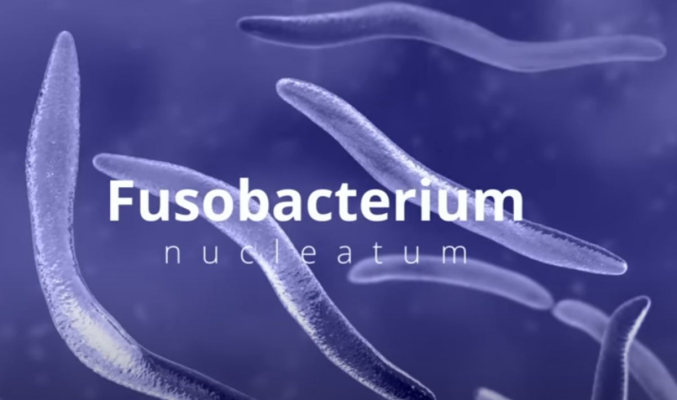 Fusobacterium, o bacterie care poate vindeca „boala secolului“. Corpul nostru o produce natural
